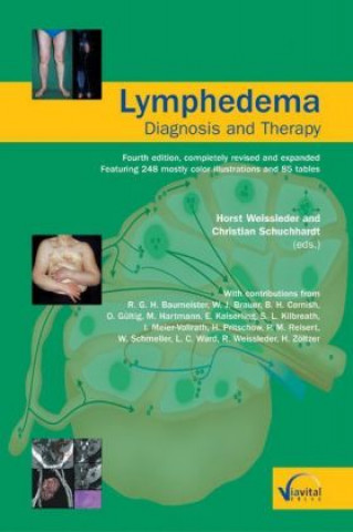 Lymphedema-Diagnosis and Therapy