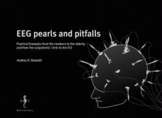 EEG pearls and pitfalls