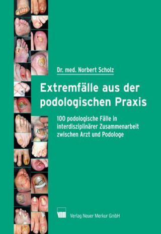 Extremfälle aus der podologischen Praxis