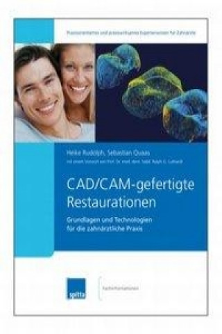 CAD/CAM-gefertigte Restaurationen