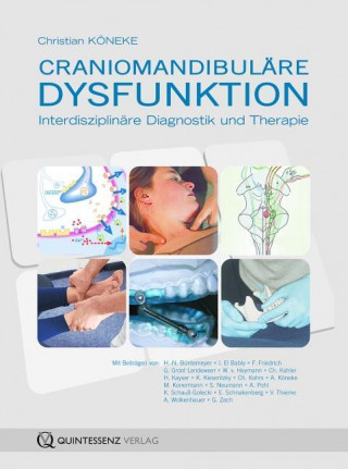 Craniomandibuläre Dysfunktion  