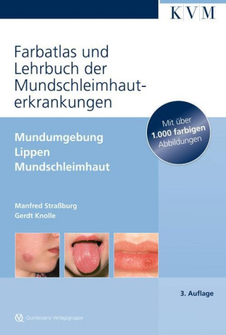 Bildatlas und Lehrbuch der Mundschleimhauterkrankungen