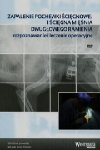 Zapalenie pochewki sciegnowej isciegna miesnia dwuglowego ramienia