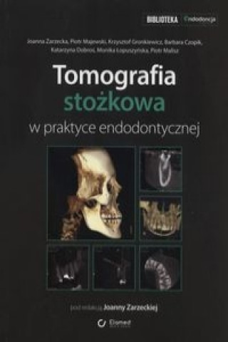 Tomografia stozkowa w praktyce endodontycznej