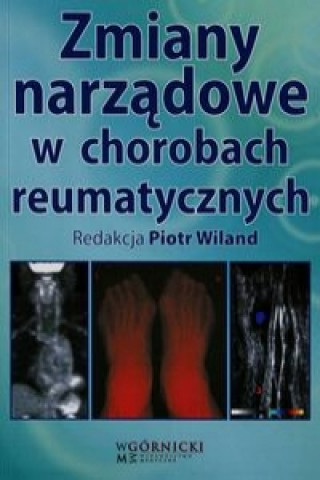 Zmiany narzadowe w chorobach reumatycznych