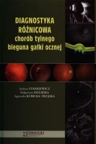 Diagnostyka roznicowa chorob tylnego bieguna galki ocznej