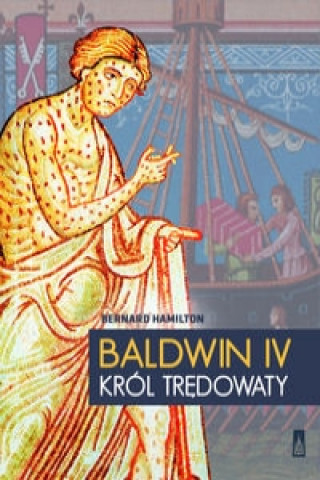 Baldwin IV, krol tredowaty