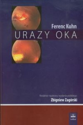 Urazy oka