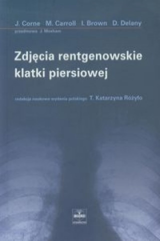 Zdjecia rentgenowskie klatki piersiowej