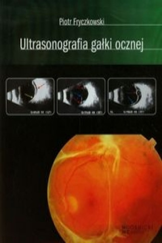 Ultrasonografia galki ocznej