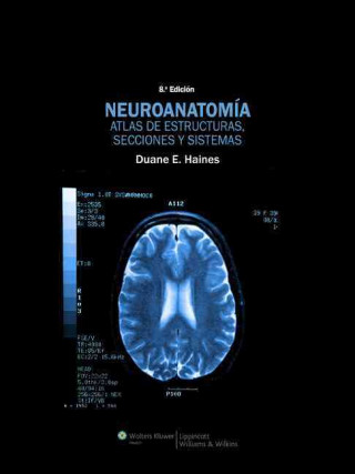 Neuroanatomía : atlas de estructuras, secciones y sistemas