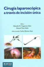 Cirugía laparoscópica a través de incisión única