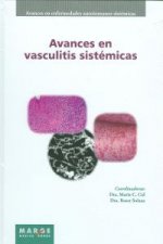 Avances en vasculitis sistemicas