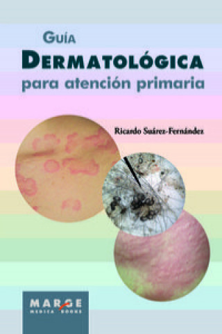 Guía dermatológica para atención primaria