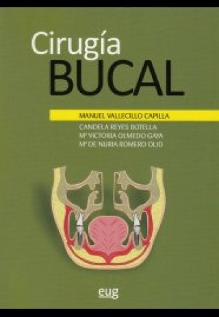Cirugía bucal