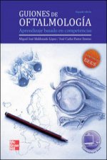 Guiones de Oftlamologia