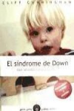 El Síndrome de Down