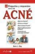 Preguntas y respuestas acerca del acné