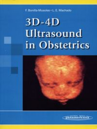 3D-4-D ultrasound in obstetrics