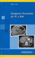 Imágenes normales de TC y RM