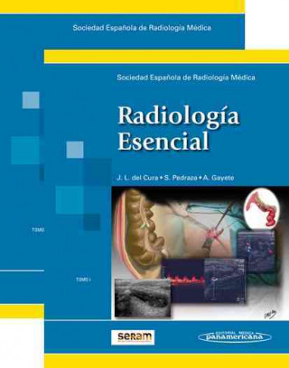 Radiología Esencial (2Tomos)
