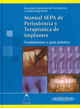 Manual SEPA de periodoncia y terapéutica de implantes. Fundamentos y guía práctica