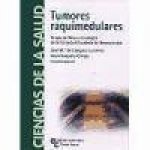 Tumores raquimedulares