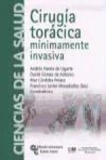 Cirugía torácica : mínimamente invasiva