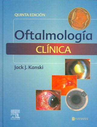 Oftalmologia