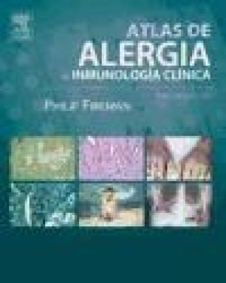 Atlas de Alergia E Inmunolog?a Cl?nica + CD-ROM