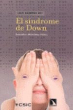 El síndrome de Down