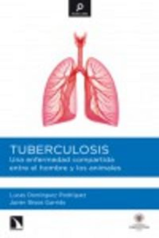 Tuberculosis : una enfermedad compartida entre el hombre y los animales