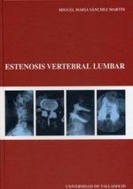 Estenosis vertebral lumbar