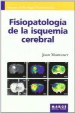 Fisiopatología de la isquemia cerebral
