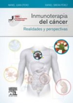 Inmunoterapia del cáncer : realidades y perspectivas