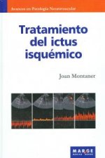 Tratamiento de ictus isquémico
