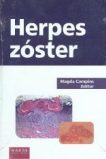 Herpes zóster