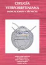 Cirugía vitreorretiniana : indicaciones y técnicas
