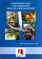 Anestesia y reanimación práctica en imágenes