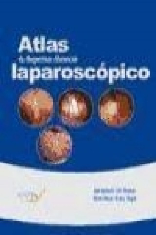 Atlas de diagnóstico diferencial laparoscópico