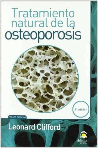 Tratamiento natural de la osteoporosis