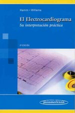 Lista de control : electrocardiograma