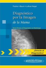 Diagnóstico por la imagen de la mama