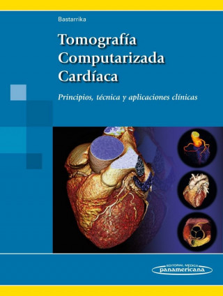 Tomografía Computarizada Cardíaca