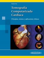 Tomografía Computarizada Cardíaca