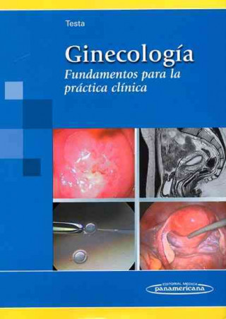 Ginecología. Fundamentos para la práctica clínica