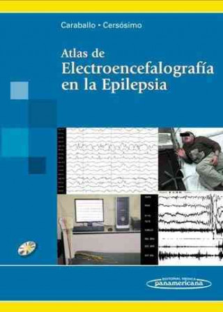 Atlas de Electroencefalografía en la Epilepsia