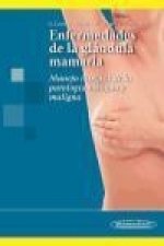 Enfermedades de la glándula mamaria: Manejo integral de la patología benigna y maligna