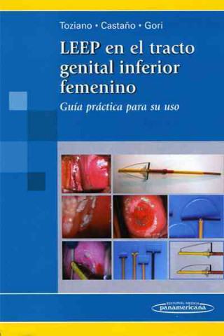 Leep en el Tracto Genital Inferior Femenino. Guía practica para su uso