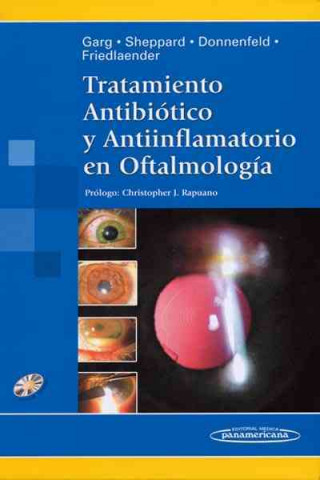 Tratamiento Antibiótico y Antiinflamatorio en Oftalmología